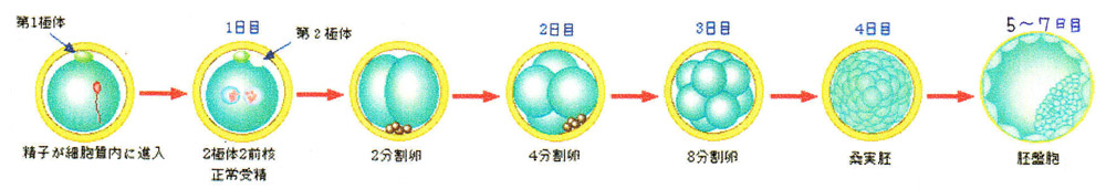 体外受精 胚移植ついて 山口レディスクリニック 名古屋市南区 不妊治療専門 不妊症相談 不妊検査 人工授精 体外受精 顕微授精