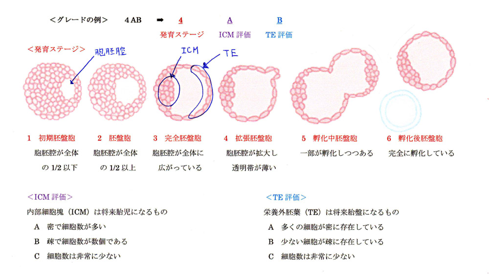 胚 盤 胞 グレード